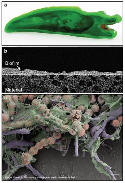 biofilms