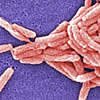 legionella