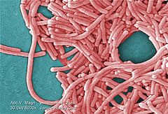 legionella