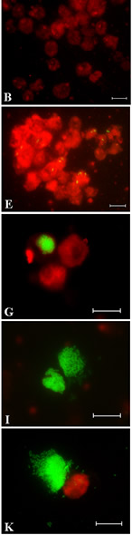 legionella