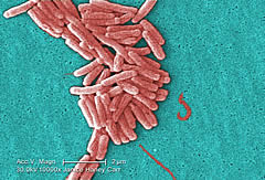 legionella pneumophila