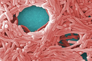 legionella