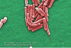 legionella