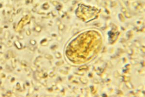 giardia