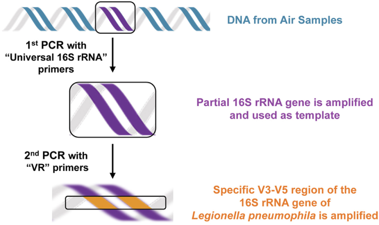 legionella