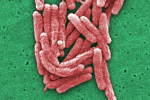 legionella