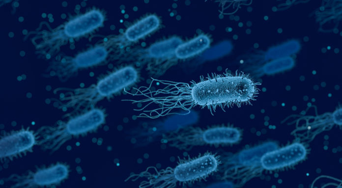 legionella