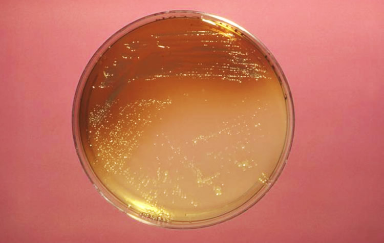 Técnicas rápidas de detección de Legionella, una necesidad para la prevención eficiente