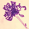 aspergillus