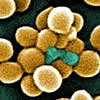 staphylococcus aureus