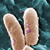 pseudomonas-aeruginosa