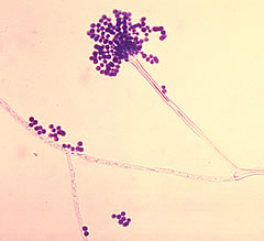 aspergillus