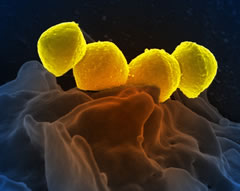 bacterias