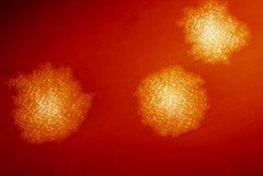 clostridium difficile
