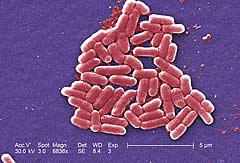 E.Coli