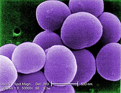 mrsa