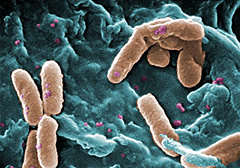 pseudomonas-aeruginosa