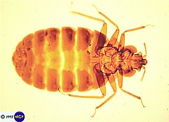 cimex lectularius