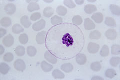 plasmodium