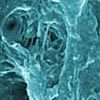 biofilm