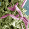 campylobacter