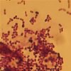 streptococcus lactis