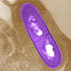 listeria