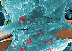 biofilm