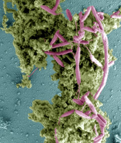 campylobacter