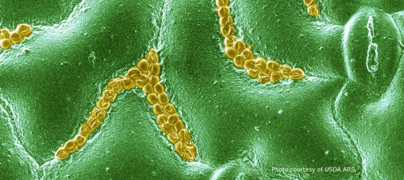 giardia y cryptosporidium