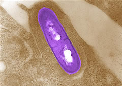 listeria