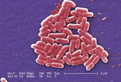 e.coli