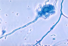 aspergillus