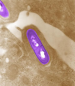 listeria