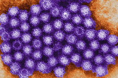 norovirus