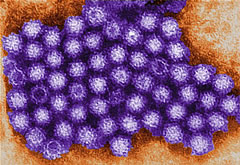 norovirus