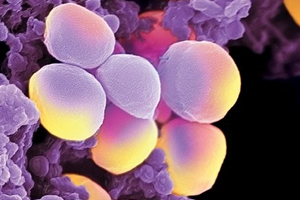 Staphylococcus aureus