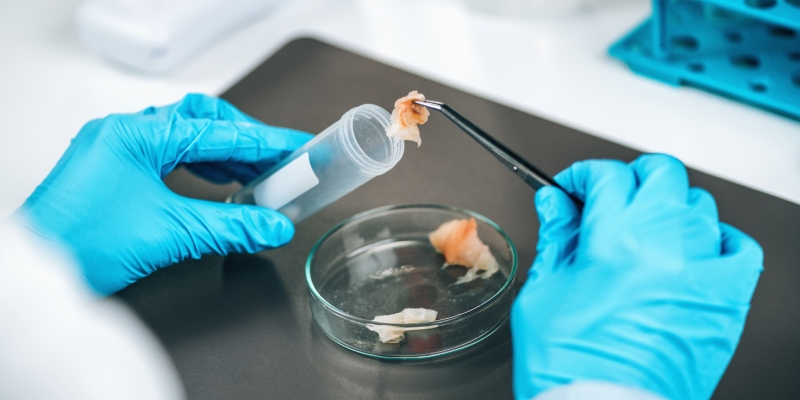 estudios de vida util en relacion a Listeria monocytogenes