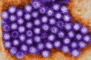 norovirus