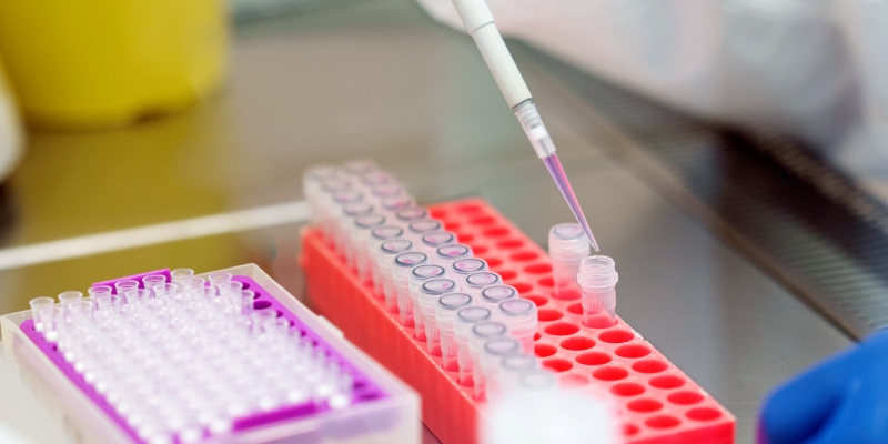 identificacion molecular de Salmonella