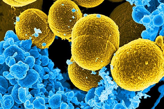 staphylococcus aureus