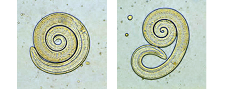 triquinosis