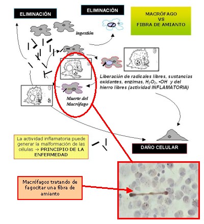 Figura (5): Detalle del esquema de actuación de la última barrera defensiva del organismo frente a las fibras de amianto, los macrófagos, una vez superadas las fosas nasales y las células ciliadas de la traquea.