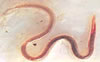 Nematodo