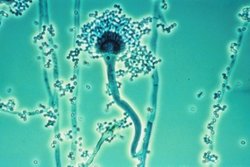 aspergillus5.jpg