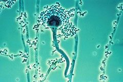 aspergillus6.jpg