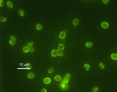 cryptosporidium_parvum_01.jpg