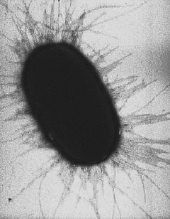 ecoli-entero2.jpg