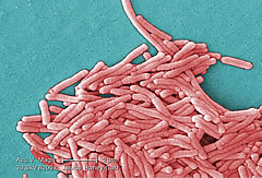 legionella-separ.jpg