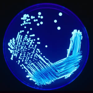 legionella.jpg